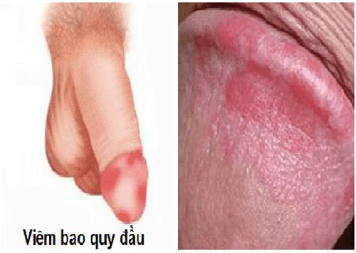 Block Image